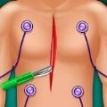 �������ҽԺ(Heart Surgery)